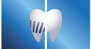 واترجت دندان فیلیپس شارژی مدل HX8331