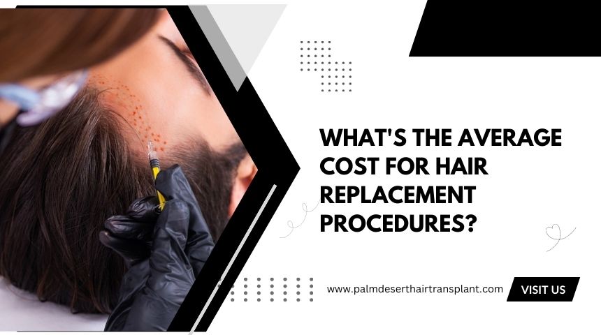 What's the Average Cost for Hair Replacement Procedures?